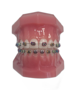 Типодонт с металлическими лигатурными мини брекетами Rainbow фото в интернет-магазине Дентаурум