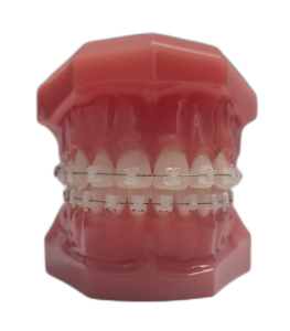 Типодонт с сапфировыми самолигирующими пассивными брекетами Elegant фото в интернет-магазине Дентаурум