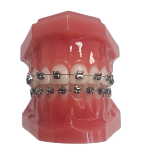 Типодонт с металлическими самолигирующими интерактивными брекетами Liberty фото в интернет-магазине Дентаурум