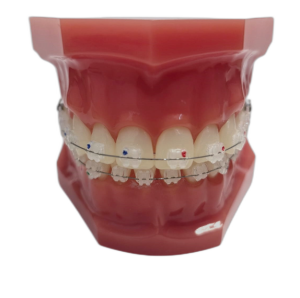 Типодонт с керамическими лигатурными брекетами Snowy фото в интернет-магазине Дентаурум