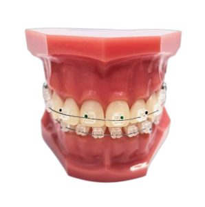 Типодонт с сапфировыми лигатурными брекетами Christal фото в интернет-магазине Дентаурум