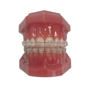 Типодонт с керамическими самолигирующими пассивными брекетами Eros фото в интернет-магазине Дентаурум