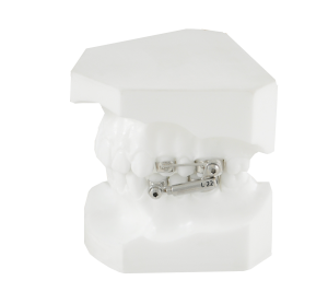 Аппарат Гербста TS 22 мм фото в интернет-магазине Дентаурум