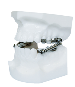 Аппарат Гербста 1 фото в интернет-магазине Дентаурум