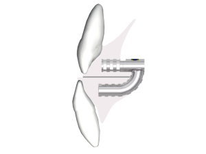 Винт расширяющий для активатора при лечении мезиальной окклюзии по Weise расширение 5 мм фото в интернет-магазине Дентаурум