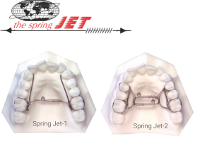 Аппарат для расширения зубного ряда Spring Jet фото в интернет-магазине Дентаурум