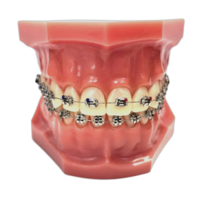 Типодонт с металлическими лигатурными стандартными брекетами Rainbow фото в интернет-магазине Дентаурум