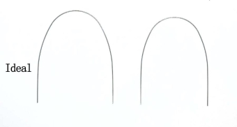 Дуга нитиноловая супер-эластичная NiTi идеальная форма 17х25 в/ч фото в интернет-магазине Дентаурум