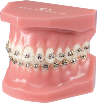 Брекеты лигатурные металлические Discovery Smart Roth 018 кр.3,4,5, 20 шт. фото в интернет-магазине Дентаурум