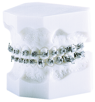 Брекеты лигатурные металлические Discovery Roth 018 кр.3,4,5, 20 шт. фото в интернет-магазине Дентаурум