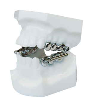 Аппарат Гербста 4 фото в интернет-магазине Дентаурум Аппарат Гербста 4 фото в интернет-магазине Дентаурум